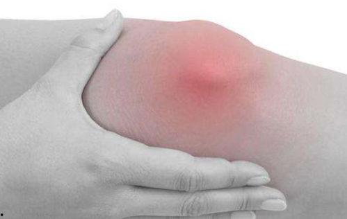 患痛风的篮球明星,揭秘患痛风的篮球明星传奇”